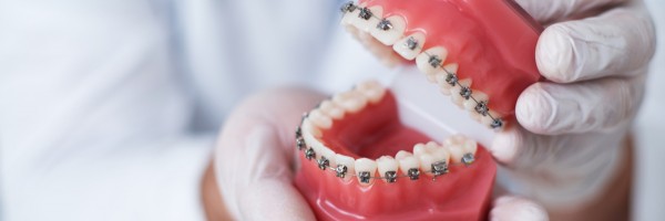 5 Types Of Braces: Which Ones Are Right For Your Child?