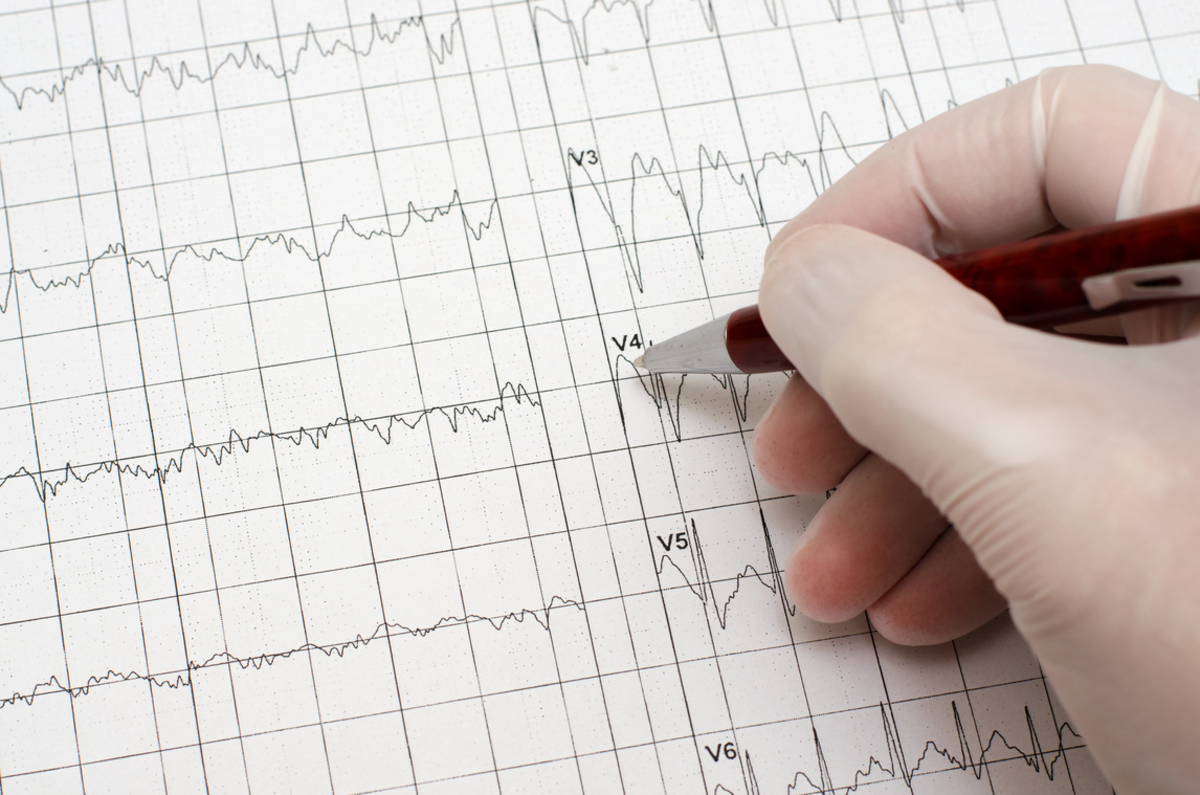 how-is-heart-disease-diagnosed-5-different-medical-tests-for-coronary