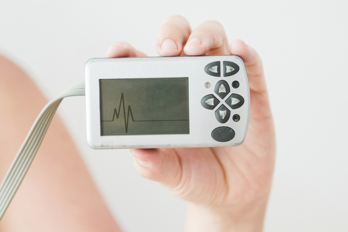 arrhythmia monitor