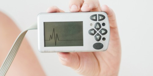 4 Types Of Medical Devices Used To Help Treat Irregular Heartbeat (Arrhythmia)