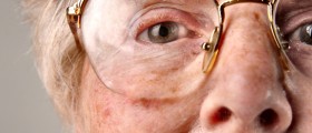 4 Things You Should Know About Muscle Spasms (Myoclonus) And Uncontrollable Twitches