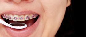 Orthodontic Treatment: What Is The Best Time To Straighten Teeth And Correct An Improper Bite?