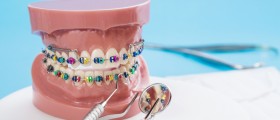 Preparing For The Orthodontist: 7 Things You Need To Know About Traditional Braces With Brackets