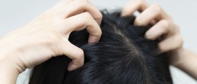 Say No To Head Lice: How Can You Prevent A Pediculosis Infestation?