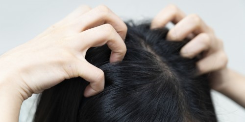 Say No To Head Lice: How Can You Prevent A Pediculosis Infestation?