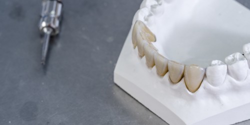 Zirconia White Dental Crowns For Kids: What Should You Know?