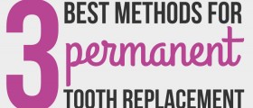 Are You Missing A Tooth? 3 Best Methods For Permanent Tooth Replacement