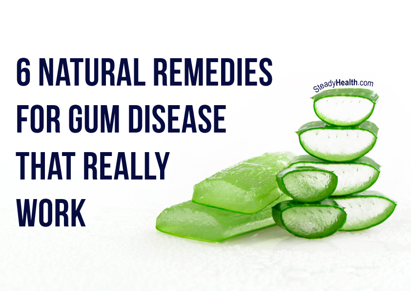 6 Natural Remedies For Gum Disease That Really Work Ear, Nose, Throat