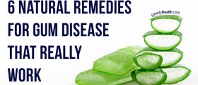 6 Natural Remedies For Gum Disease That Really Work
