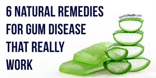 6 Natural Remedies For Gum Disease That Really Work