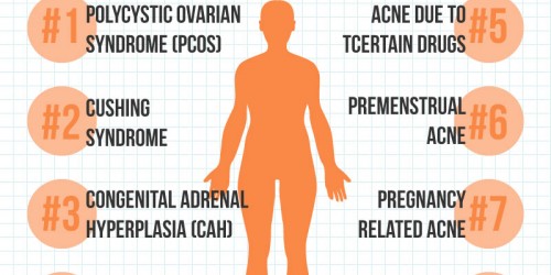 8 Medical Conditions That Might Cause Your Adult Acne