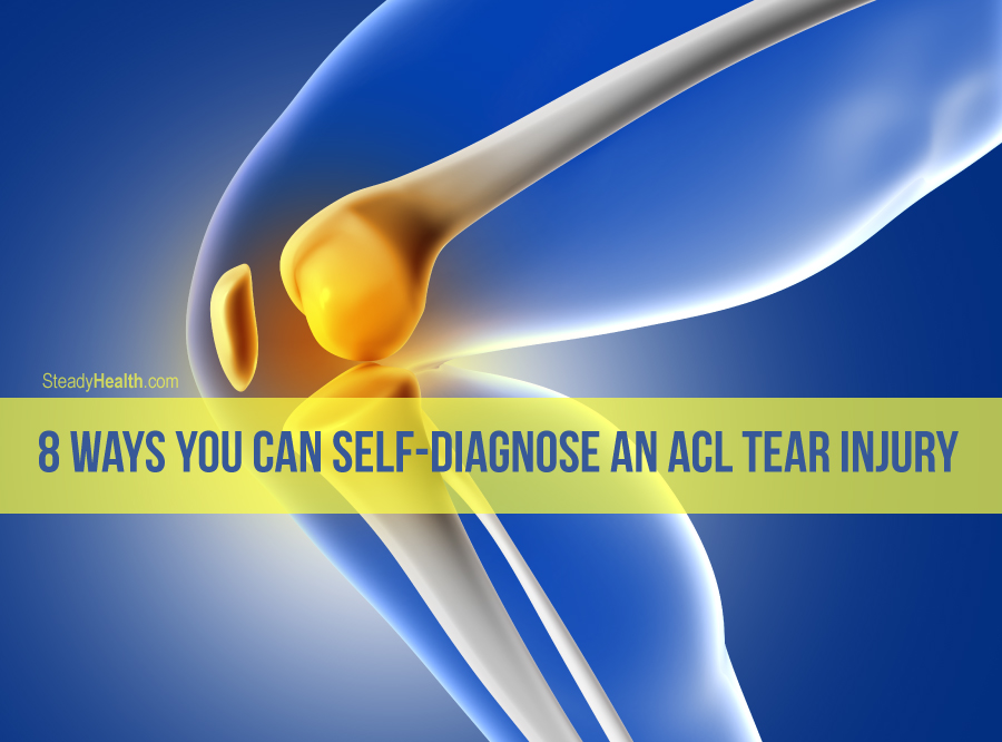 8 Ways You Can Self-Diagnose An ACL Tear Injury | Injuries, Fractures