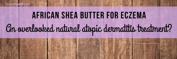 African Shea Butter For Eczema: An Overlooked Natural Atopic Dermatitis Treatment?