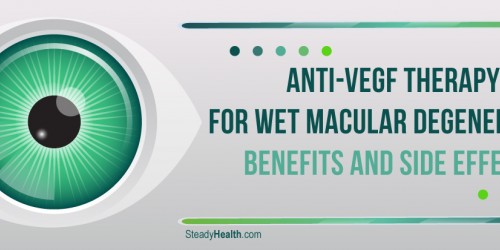Anti-VEGF Therapy For Wet Macular Degeneration Treatment: Benefits And Side Effects
