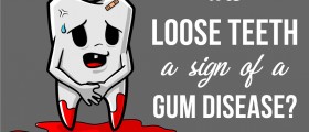 Are Loose Teeth A Sign Of A Gum Disease?