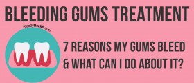 Bleeding Gums Treatment: 7 Reasons My Gums Bleed And What Can I Do About It?