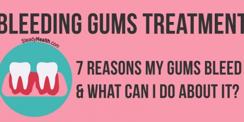 Bleeding Gums Treatment: 7 Reasons My Gums Bleed And What Can I Do About It?
