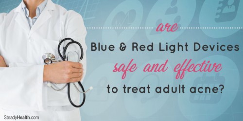 Blue And Red Light Devices To Treat Adult Acne: Are They Safe And Effective?