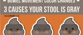 Bowel Movement Color Changes: 3 Causes Your Stool Is Gray