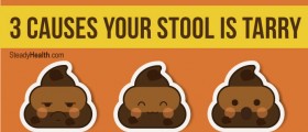 Bowel Movement Color Changes: 3 Causes Your Stool Is Tarry
