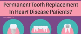 Bridges, Crowns, And Implants: Permanent Tooth Replacement In Heart Disease Patients