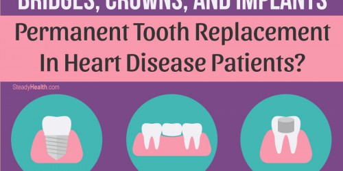 Bridges, Crowns, And Implants: Permanent Tooth Replacement In Heart Disease Patients