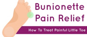 Bunionette Pain Relief: How To Treat Painful Little Toe