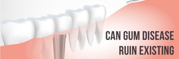 Can Gum (Periodontal) Disease Ruin Existing Dental Implants? Does It Make New Ones Impossible?