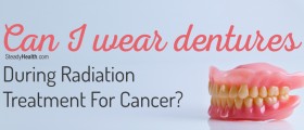 Can I Wear Dentures During Radiation Treatment For Cancer?