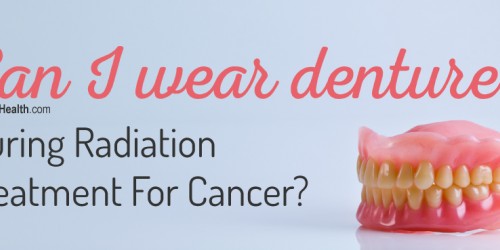 Can I Wear Dentures During Radiation Treatment For Cancer?