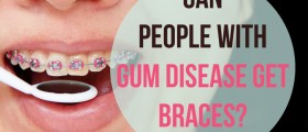 Can People With Gum Disease Get Braces?