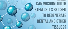 Can Wisdom Tooth Stem Cells Be Used To Regenerate Dental and Other Tissues?