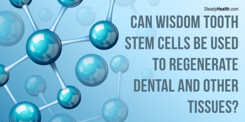 Can Wisdom Tooth Stem Cells Be Used To Regenerate Dental and Other Tissues?