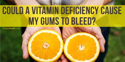 Could A Vitamin Deficiency Cause My Gums To Bleed?