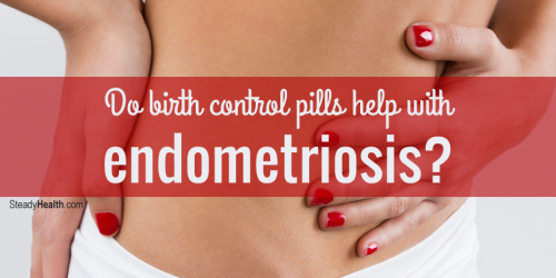 Do Birth Control Pills Help With Endometriosis?