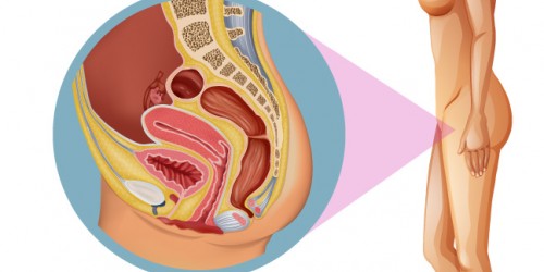 7 Things Women With PCOS Should Know About Endometrial Cancer
