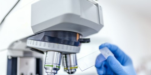 8 Potential Causes And Risk Factors Of ALS