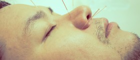 Acupuncture and Allergic Rhinitis: Is This A Safe and Effective Solution For Your Runny Nose?