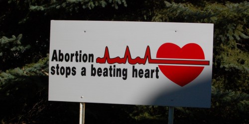 Trying To Conceive Reviews: The 180 Abortion Documentary