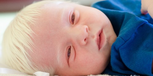 Conceiving Naturally With Endometriosis: Is It Possible?