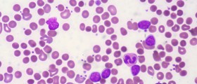 Common Autoimmune Disorders And How To Deal With Them