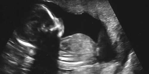 What To Expect From Your First Ultrasound During Pregnancy