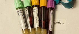 The Daily Schedule Of A Haematologist