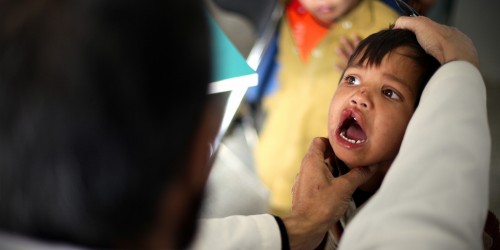 What Parents Need To Know About Cleft Lip And Cleft Palate