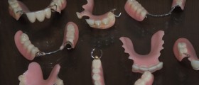 What Are Flexible Dentures? How Are They Better Than Conventional Dentures?