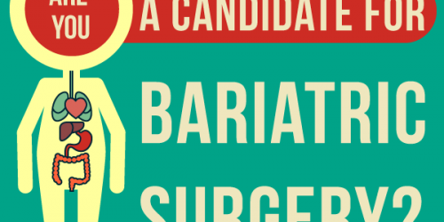 Who Should Consider Bariatric Surgery To Lose Weight?