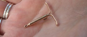 Birth control: Why you should consider an intrauterine device