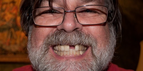 What Will Happen If You Do Not Replace A Missing Tooth?