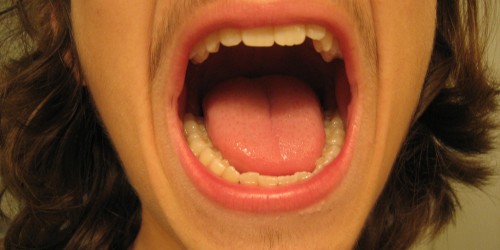 What Is That White Patch Inside Your Mouth?