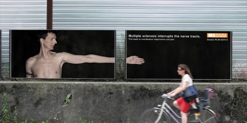 Is Stem Cell Transplantation A New Cure For Multiple Sclerosis?